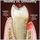 can you save your teeth from gum disease