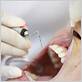 concord gum disease treatments