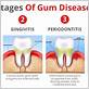 gum disease blood sugar