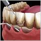 gum disease treatments rilato