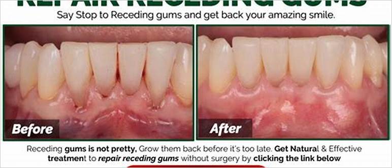 how to repair periodontal disease